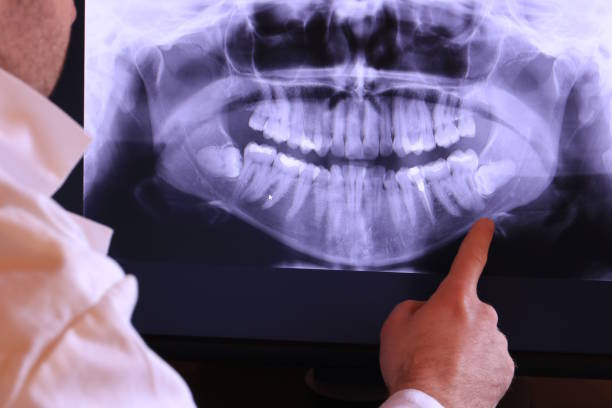 Best Emergency Treatment for Oral Infections in Venetian Vlage, IL